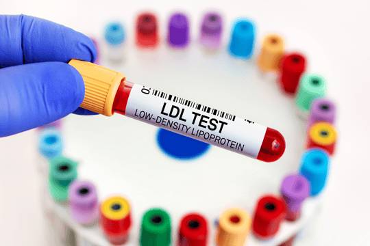 LDL
